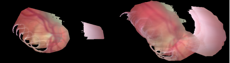 Images of successful stitching of video frames for the back of the retina.