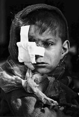 Kurdish boy with bandage, Kurdistan, Iran, August 1980