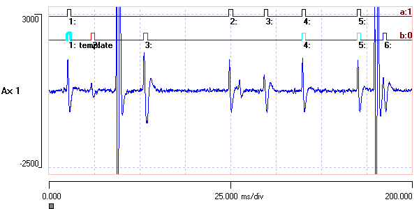 file r3s chart view